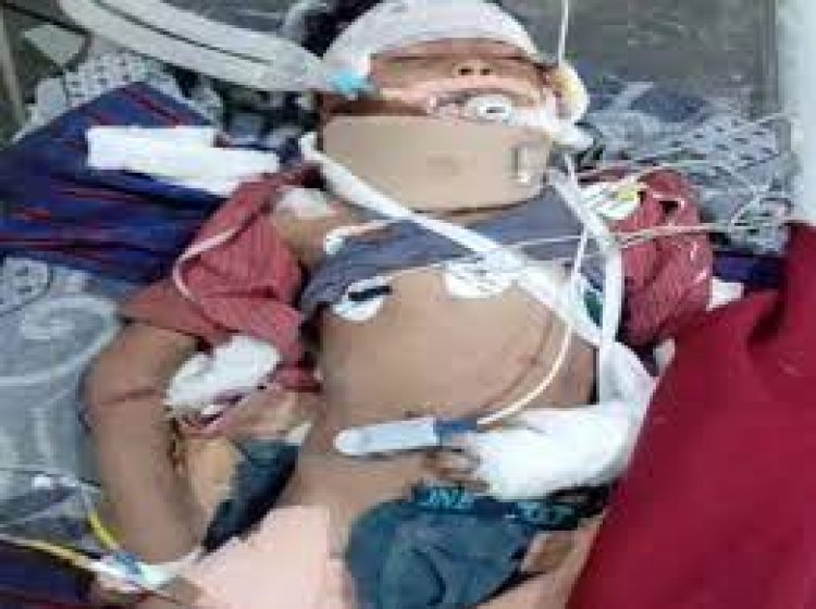 कांकेर हादसे में घायल बच्चे गौतम की हुई मौत